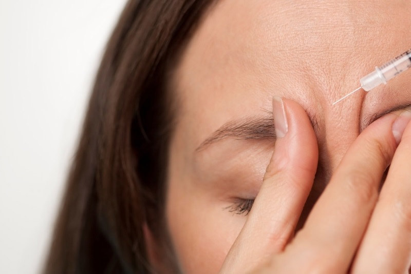 Tiêm botox xóa rãnh cau mày tốt không