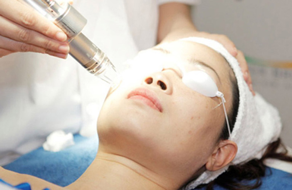 Mẹo chăm sóc da sau đốt tàn nhang