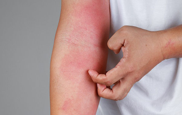 Một số kinh nghiệm khi khám bệnh về da liễu