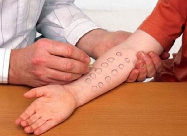 Những kinh nghiệm khi khám bệnh về da liễu