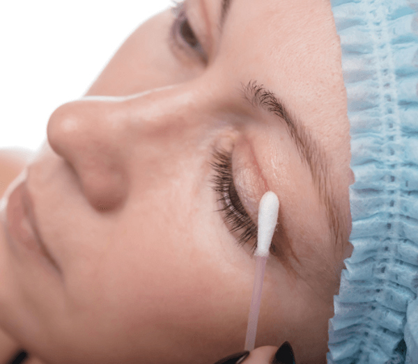 Có được bôi thuốc mỡ sau cắt chỉ mí mắt