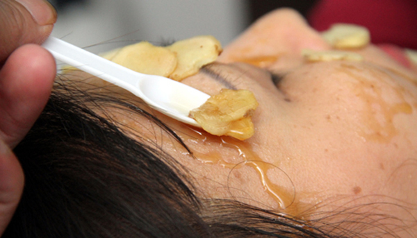 Cách trị tàn nhang bằng gừng