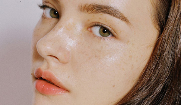 Trị tàn nhang bằng kem đánh răng