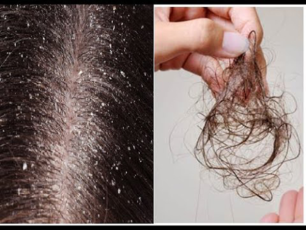 Cách kích thích mọc tóc