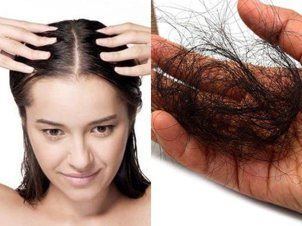 Nguyên nhân gây rụng tóc