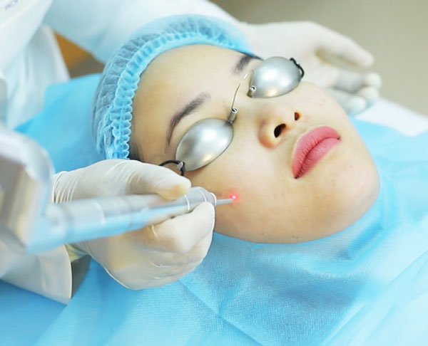 Trị mụn thịt tại Hải Phòng