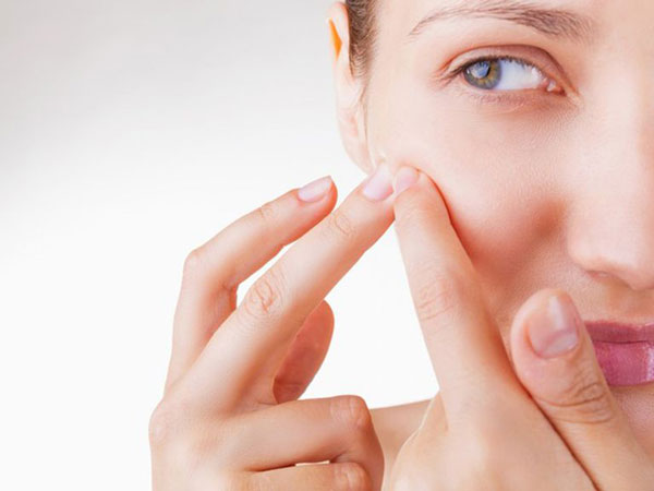 Mụn mủ có nên nặn không? Những lưu ý khi nặn mụn mủ