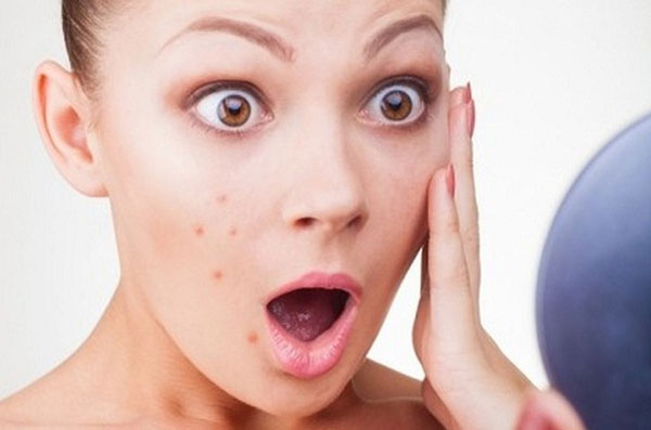 Tại sao vào màu hè da nổi mụn