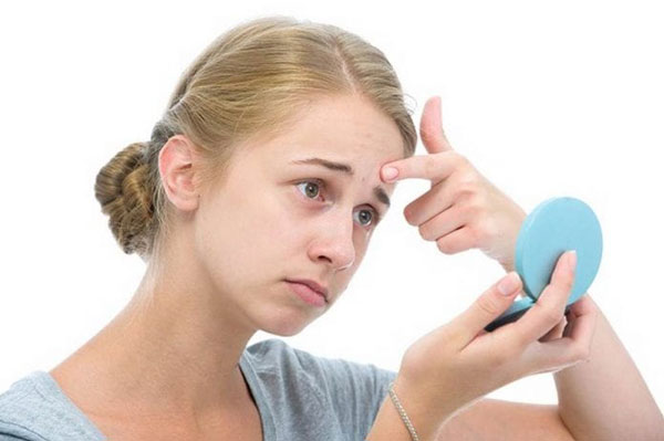 Bí quyết trị mụn cám hiệu quả