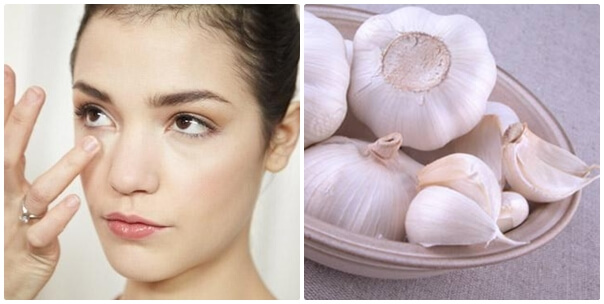 Cách trị mụn bằng tỏi
