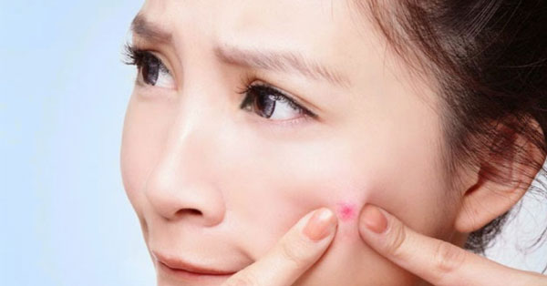 Mụn nhọt bị sưng to và cách điều trị