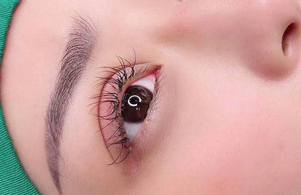 Đặc điểm của cắt mí mini và cắt mí thông thường