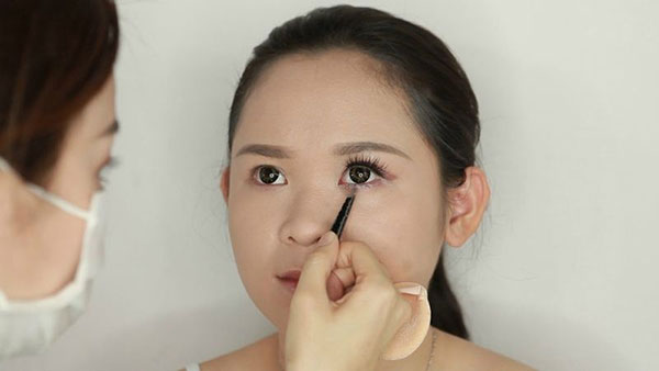 Thông tin cơ bản về cắt mí mini và cắt mí thông thường