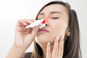 Nâng mũi bị chảy máu có làm sao không?