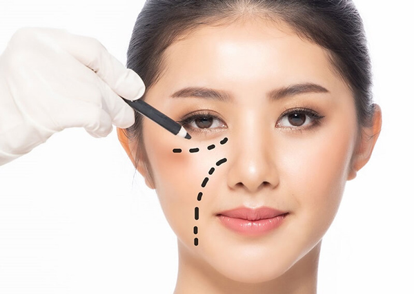 Cắt mí mắt dưới có để lại sẹo không?