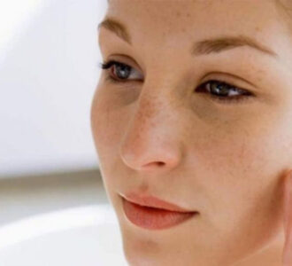 Làm thế nào để phân biệt tàn nhang với nốt ruồi