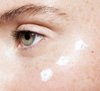 Mọi điều cần biết về tàn nhang ở mắt