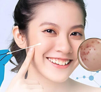 Chấm tàn nhang có hiệu quả không
